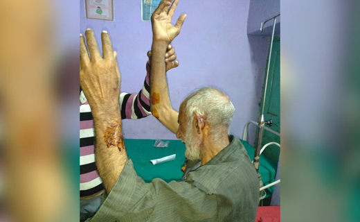 beaten up 23 jul 18